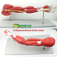 MUSCLE03(12025) Human Muscles of Arm with Main Vessels and Nerves(Anatomical Model) 12025